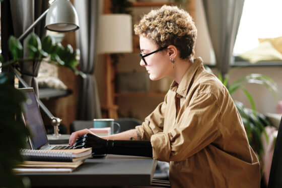 A young woman with short hair, glasses, and prosthetic arm working on her laptop reading an article titled side business ideas